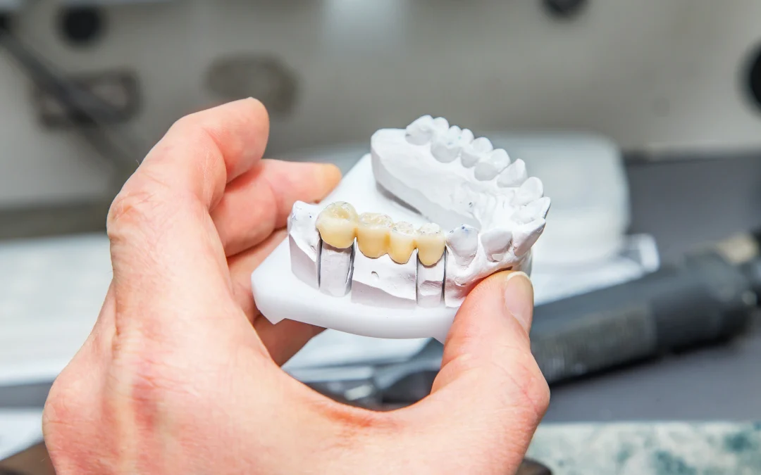 What If You Can’t Get Dental Implants? Your Other Options